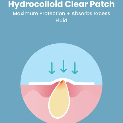 LUXURY 120 Count Skincare Hydrocolloid Clear Patches in 3 Sizes