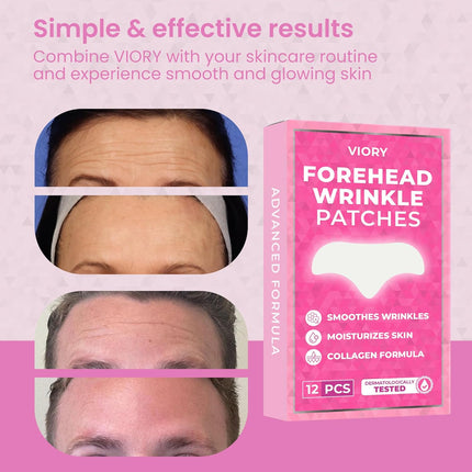 VIORY Forehead Wrinkle Patches 12Pcs with Aloe, Collagen, Vitamin E, Anti Wrinkle Patches, Forehead Wrinkles Treatment