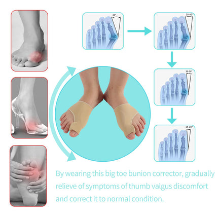XREKNOi Bunion Corrector Sleeve Socks with Big Toe Separators and Pinky Separators Pack for Men and Women Non-Slip Big Toe Straightener Big Toe Alignment Bunion Toe Relief Pain (Khaki, Small)