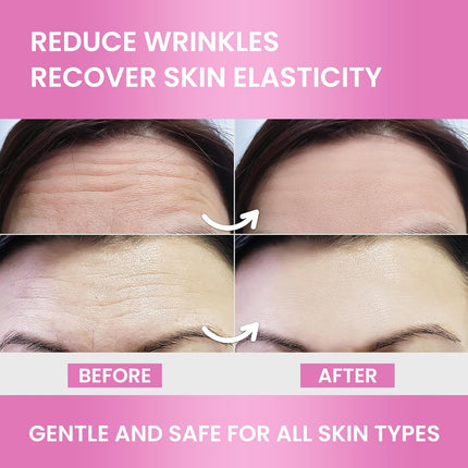 VIORY Forehead Wrinkle Patches 12Pcs with Aloe, Collagen, Vitamin E, Anti Wrinkle Patches, Forehead Wrinkles Treatment