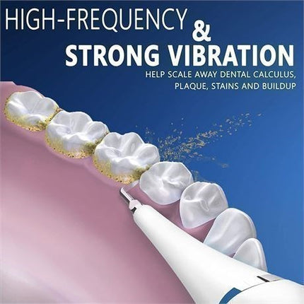 Ecardy #YJK015A Dental Calculus Remover